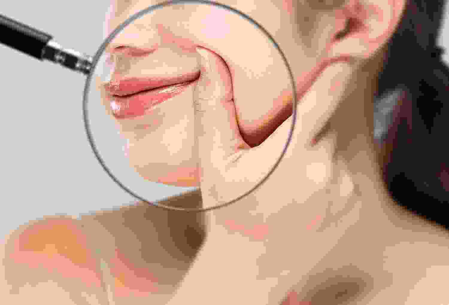 Hyperhidrosis Treatment (Excessive Sweating) Hyperhidrosis Treatment (Excessive Sweating)