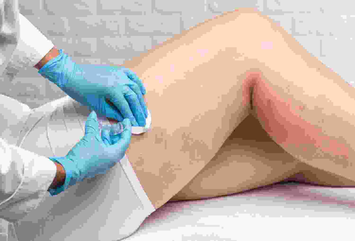 How Recovery Appears Post-Op